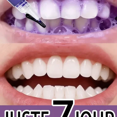 Stylo blanchissant magique pour les dents