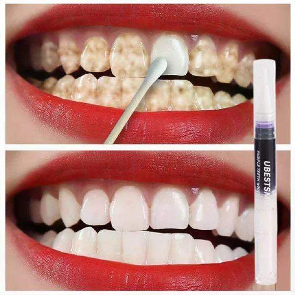 Stylos blanchissants violets pour les dents
