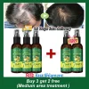 S2d5b6e3652ab47c8988ebb0c8587a5447.webp Huile essentielle de gingembre pour une croissance