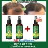 S2f01ce882d3c40c3a7abe4a1296ab03dz.webp Huile essentielle de gingembre pour une croissance