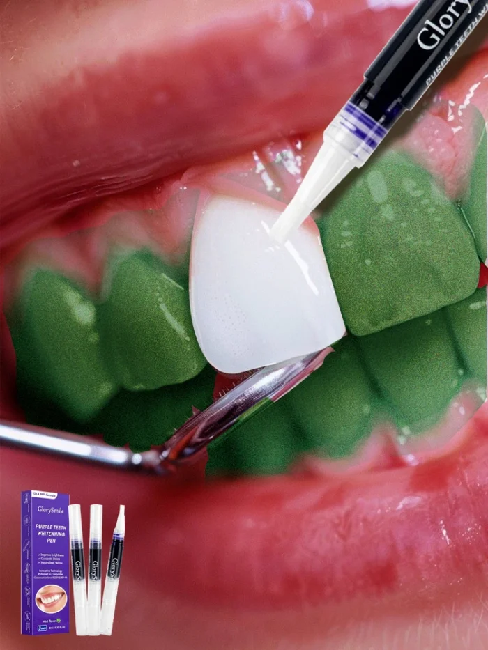 S3083c7d9832a4f14901529324faf79a0J.webp Stylo blanchissant instantané violet pour les dents