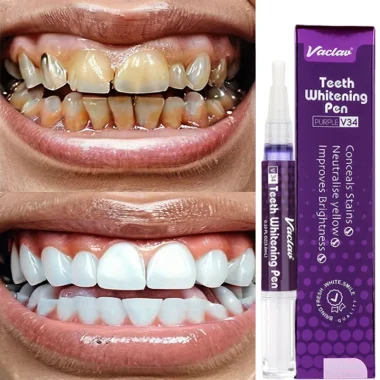 Stylo blanchissant V34, dentifrice, élimine la plaque dentaire