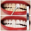 S6c4fc57c73cd44738dc4ee00cfeca7daH.webp Nettoyage des dents, élimination des taches